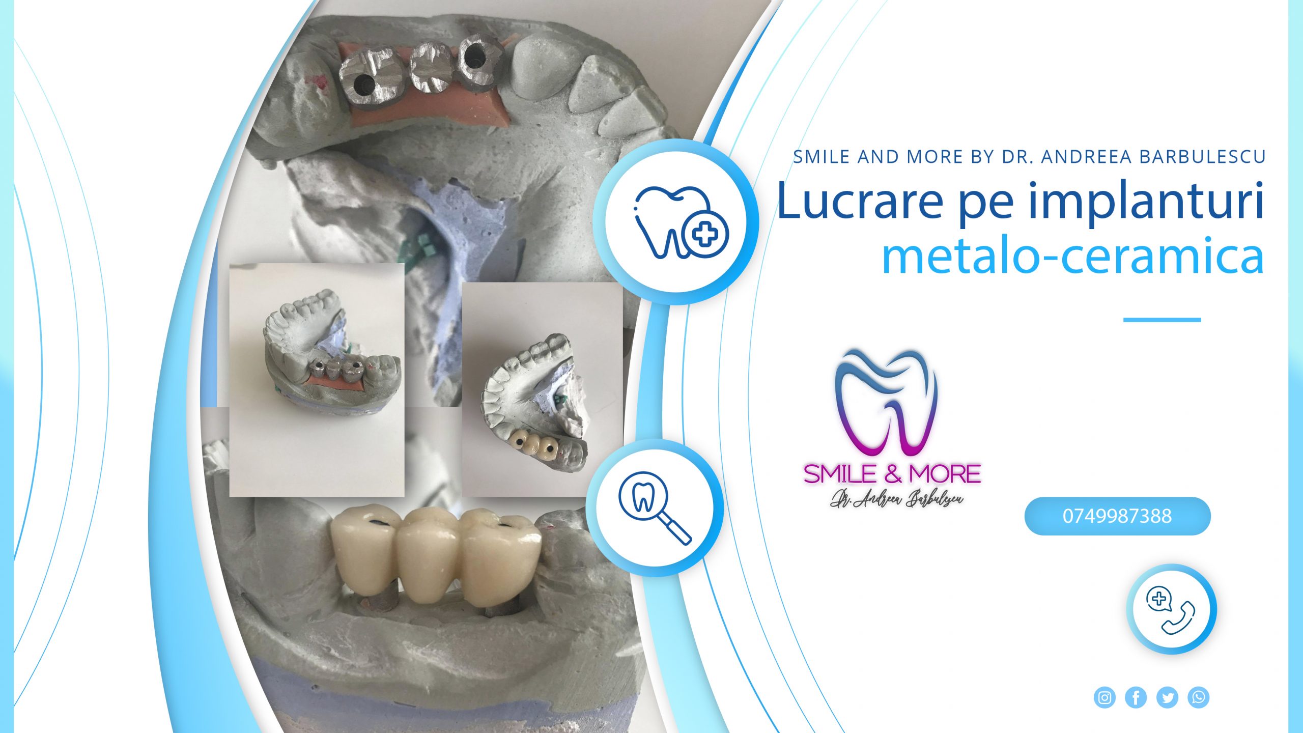 POSTARE LUCRARE DE IMPLANTURI METALO-CERAMICA